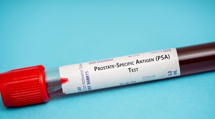 Blue background with a tube and red cap with a label on it indicating it is a PSA test.
